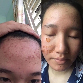 Tinh chất sâm đất