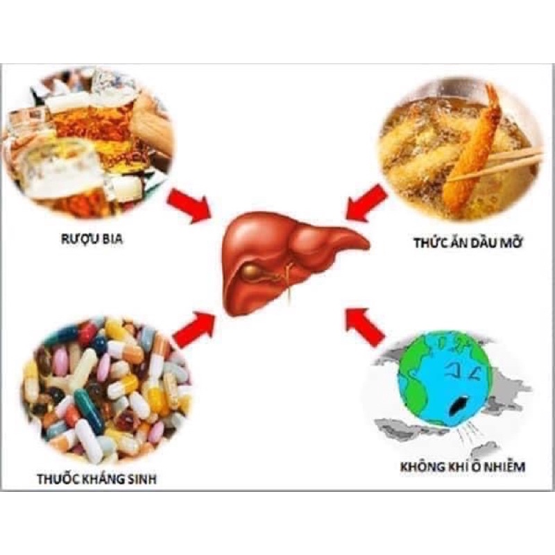 Viên uống bổ gan GNM NATURAL MILK THISTLE HÀN QUỐC 30 viên