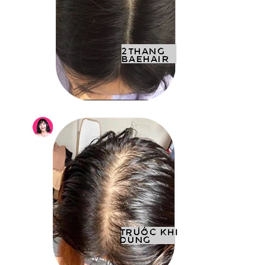 Xịt dưỡng làm dày ngăn ngừa rụng tóc Baehair Super Volume