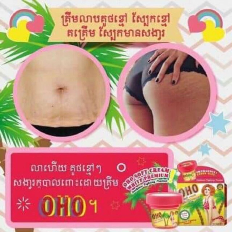 ❤️ Hàng Nội Địa | Kem Mờ Rạn Da Thần Thánh OHO Thái Lan