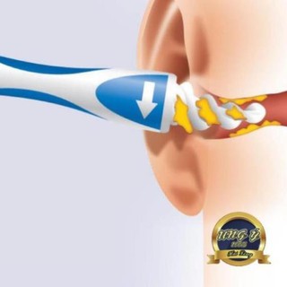 Cây lấy ráy tai thông minh Smart Swab