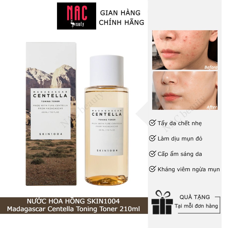 Nước Hoa Hồng Skin1004 Madagascar Centella Asiatica Toning Toner (mẫu mới)