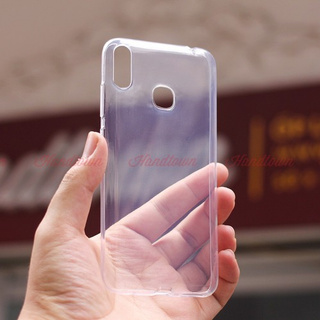 Ốp dẻo a+ vsmart joy 1+ / joy 1 plus