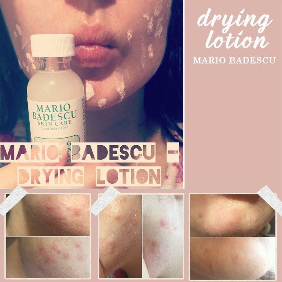 Chấm Mụn Mario Badescu Drying Lotion 29ml