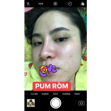 5 CHAI CỐT NHÂN SÂM