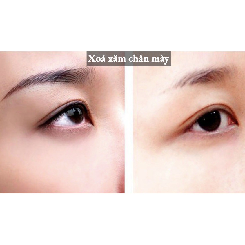 Máy xoá xăm chân mày NEATCELL- Lazer Đỏ | BigBuy360 - bigbuy360.vn