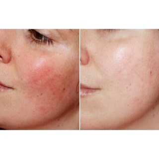 Combo Serum + Kem Dưỡng Some By Mi Snail Truecica