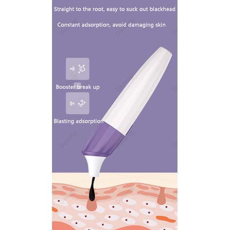 Dụng cụ hỗ trợ loại bỏ mụn đầu đen thông minh bằng điện cho vùng mũi làm sạch lỗ chân lông