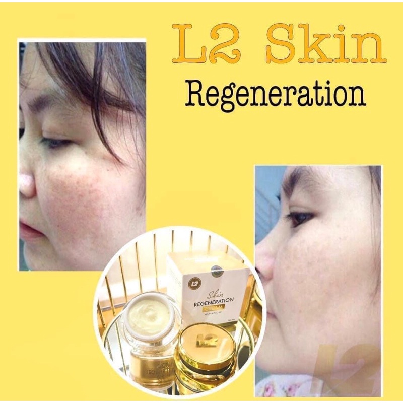 KEM TÁI TẠO DA L2 SKIN   𝐒𝐤𝐢𝐧 𝐑𝐞𝐠𝐞𝐧𝐞𝐫𝐚𝐭𝐢𝐨𝐧 𝐂𝐫𝐞𝐚𝐦 30gram