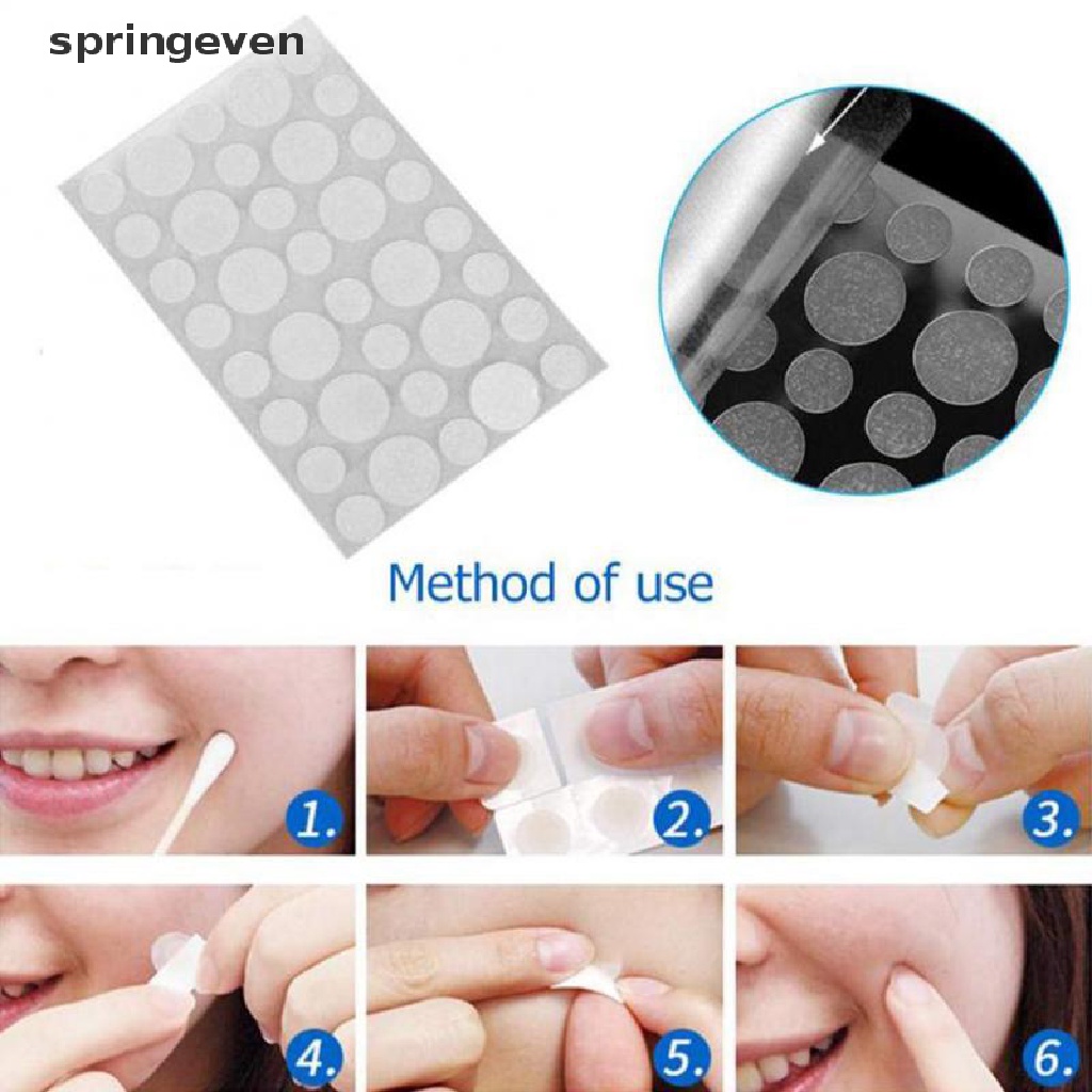 Bộ 36 Miếng Dán Mụn Hydrocolloid Và Mụn Thịt springeven  Máy Hút Bụi Cầm Tay