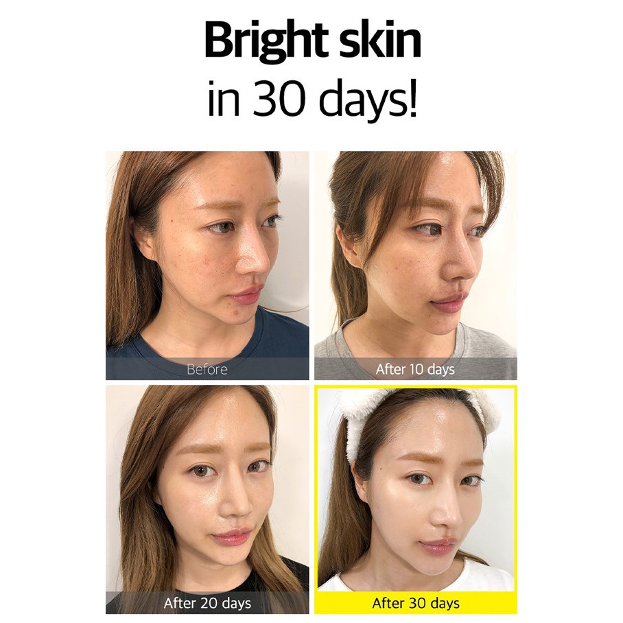 Tinh Chất Dưỡng sáng da Some By Mi Yuja Niacin 30 Days Blemish Care Serum 50ml