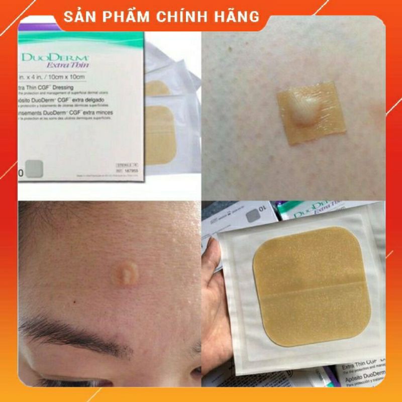 1Hộp/10 miếng dán mụn, vết thương hở,... Duoderm Extra Thin 10*10cm