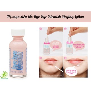 Lotion xẹp mụn Bye Bye Blemish Drying Lotion