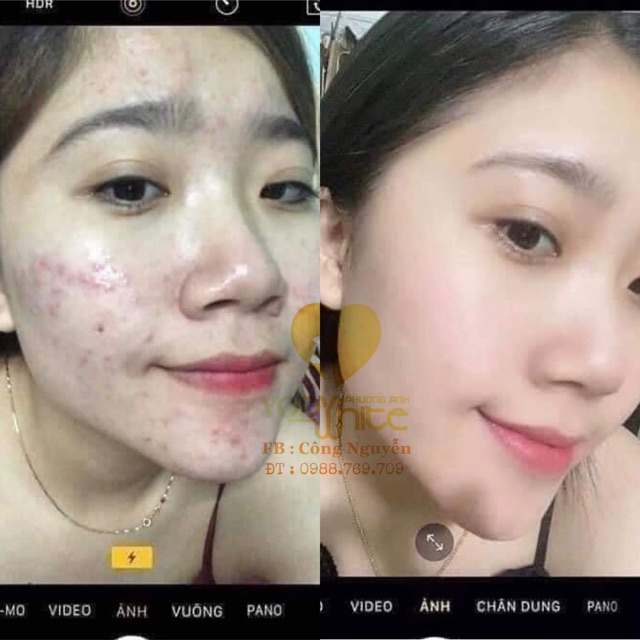 KEM DƯỠNG TRẮNG DA TÁI TẠO BAN ĐÊM SU SKIN