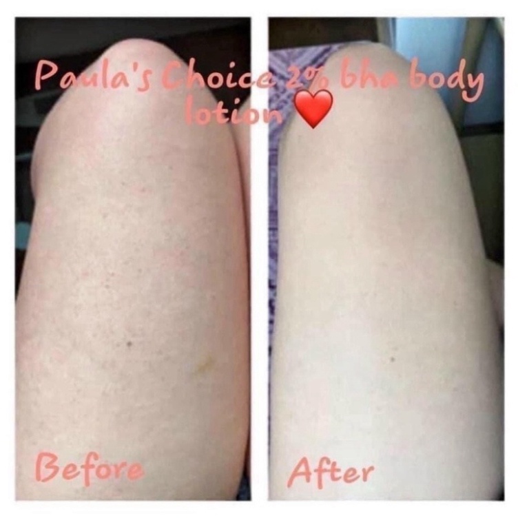 KEM DƯỠNG BHA BODY 2% PAULACHOI