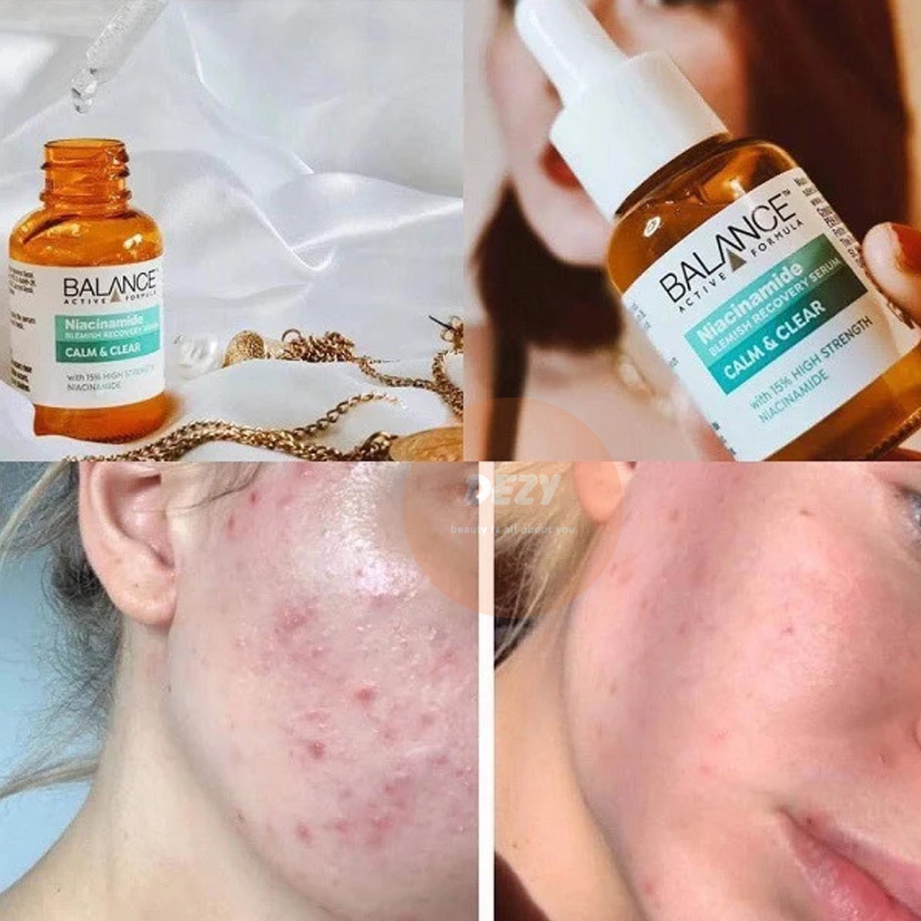 Serum Vitamin C Balance Trắng Da Brightening Giảm Nếp Nhăn Li Ti - Collagen Dưỡng Sáng Da Cho Da Nhạy Cảm Skincare Dezy | BigBuy360 - bigbuy360.vn