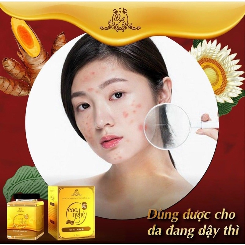 [CHÍNH HÃNG] Cao Nghệ Collagen X3