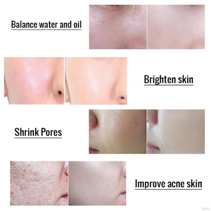 [Hàng mới về] Tinh chất Glycolic Acid 70% làm sáng da se khít lỗ chân lông cân bằng nước và kiềm dầu