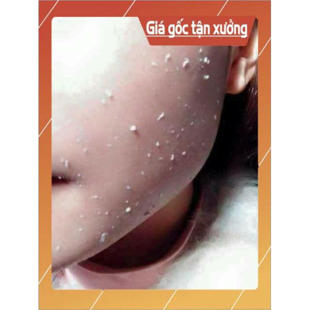 [HOT] Tẩy da chết spa ( mẫu mới, mẫu cũ ) chọn ngẫu nhiên mầu