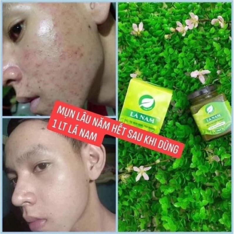 Cao Lá Nam - Xóa bỏ Nám, Tàn nhan và Thâm mụn sau 7 ngày sử dụng