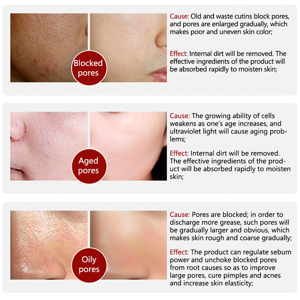 Serum Hyaluronic Acid Dưỡng Ẩm Se Khít Lỗ Chân Lông Và Phục Hồi Da Khô