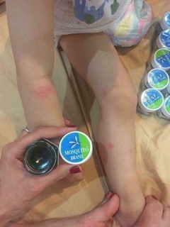 Dầu thoa muỗi cho bé .