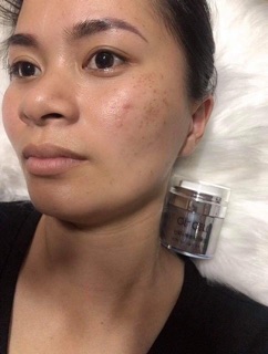 [ Hàng chính hãng ] Hút nám, tàn nhang OL - CELL