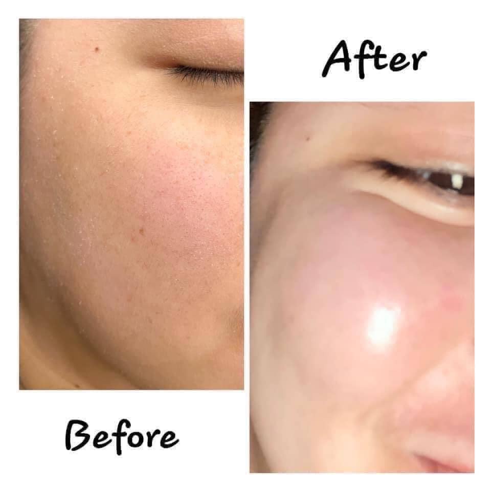 Tinh chất Mediphar Hydrating B5