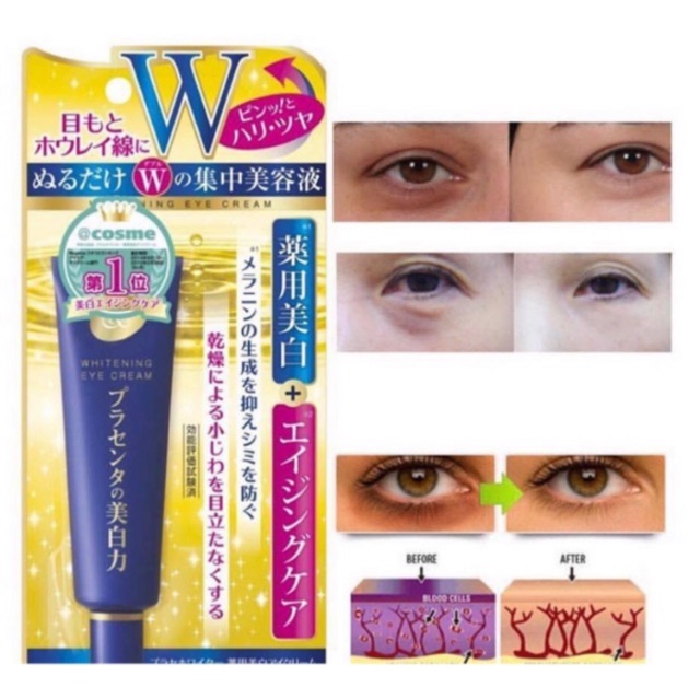 Kem mờ thâm làm sáng da vùng mắt MEISHOKU WHITENING EYES CREAM 30g Nhật Bản | BigBuy360 - bigbuy360.vn