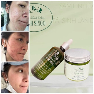 Sâm tái tạo đông y Hạnh Sinoo