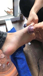 Mây chà gót chân tẩy tế bào chết