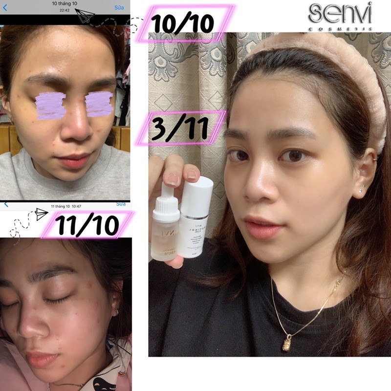 Kem dưỡng retinol 0,3% SenVi