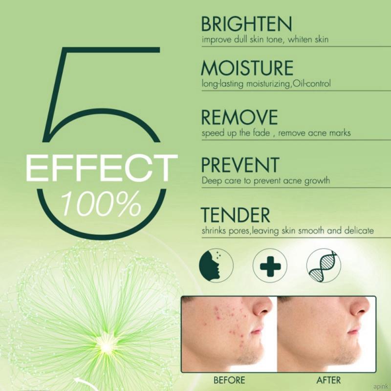 [Hàng mới về] Kem Giảm Mụn Dưỡng Ẩm Thu Nhỏ Lỗ Chân Lông Làm Săn Chắc Da 20g