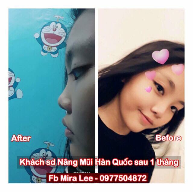 Serum Nâng Cao Mũi