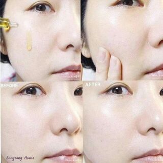 Tế Bào Gốc ELDAS