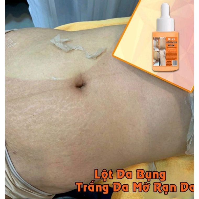 LỘT THAY DA MÔNG.HẾT THẰM MỜ RẠN.NỨT DA