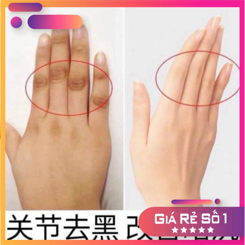 Kem Che Phủ Thâm Pibamy- Phủ Thâm Đầu Gối, Khuỷu Tay, Nách, Mắt Cá Chân - 3 Miền.vn | BigBuy360 - bigbuy360.vn