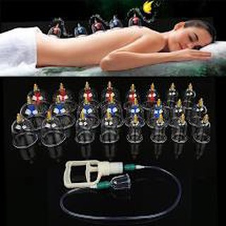 Bộ giác hơi 12 món không dùng lửa