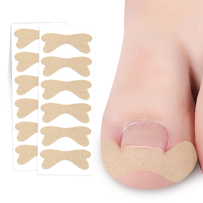 Set 6 Miếng Dán Chỉnh Sửa Móng Chân Mọc Ngược YOUYO Chuyên Nghiệp Cho Nam Và Nữ