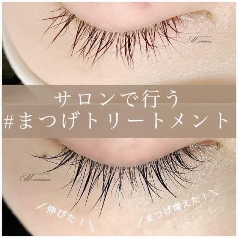 Serum Dưỡng Mi Dài Và Dày MATSUGE OMOI