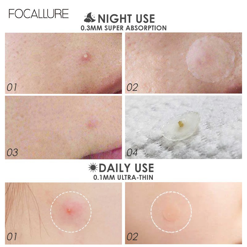 Miếng dán mụn FOCALLURE tái tạo chăm sóc làn da tiện dụng 2g