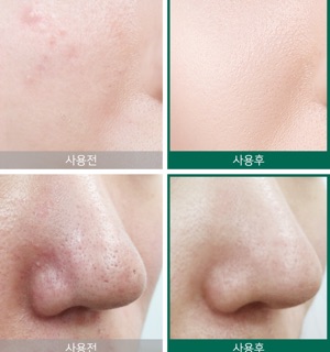 TONER AHA – BHA – PHA Miracle SOME BY MI