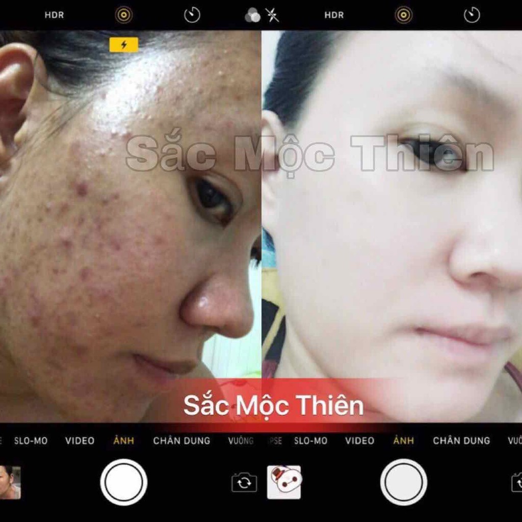 [Giá sỉ] Tinh Chất Giúp Tái Tạo Da Sắc Mộc Thiên Chính Hãng 100% mới nhất