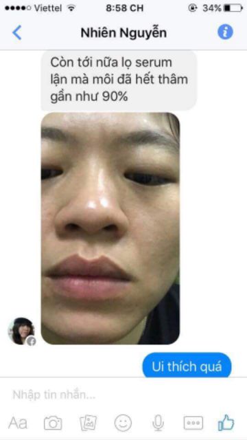 Serum Mờ Thâm Mắt / Môi / Nhũ Hoa (Mỹ Phẩm Handmade) | BigBuy360 - bigbuy360.vn