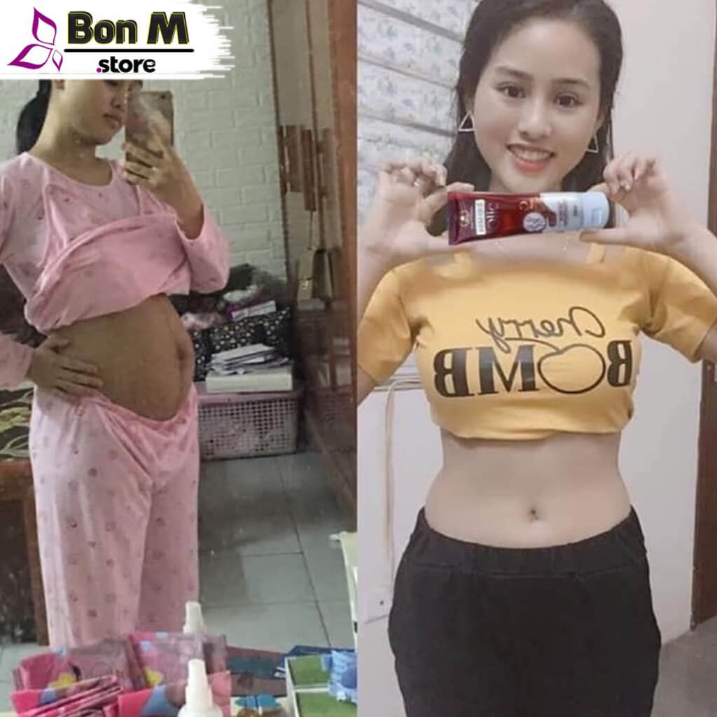 Kem Tan Mỡ Olic ⚡FREESHIP⚡ Kem Quế Olic Giảm Mỡ Bụng Siêu Tốc, Không Cần Tập Luyện | BigBuy360 - bigbuy360.vn