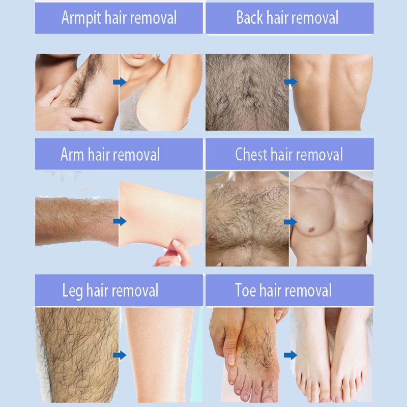 Tẩy lông không đau kem tẩy lông vĩnh viễn ức chế sự phát triển lông thân