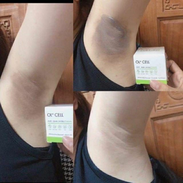 Kem thâm nách ol cell ( cam kết chuẩn 100%, chỉ bán loại 1) | BigBuy360 - bigbuy360.vn