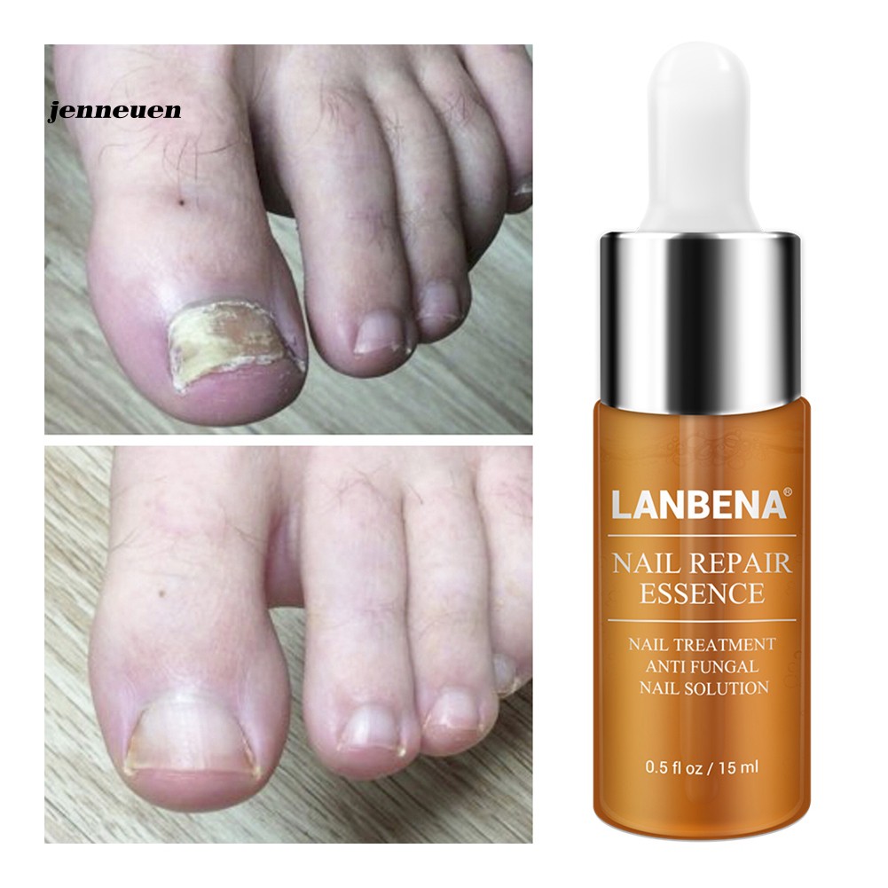 [Hàng mới về] Tinh chất phục hồi móng tay chống nấm 15ml | BigBuy360 - bigbuy360.vn