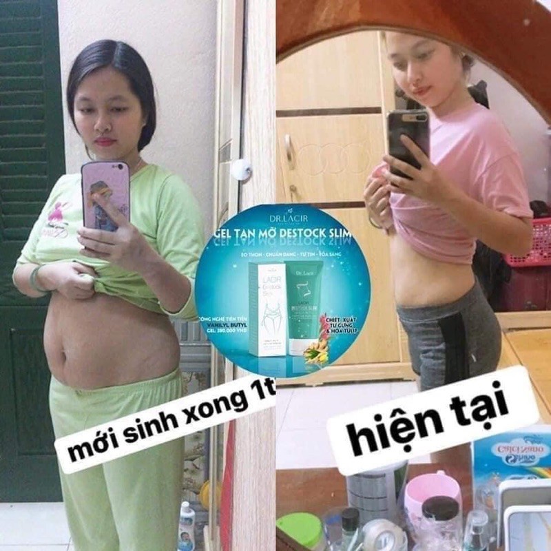 kem tan mỡ lacir destock slim