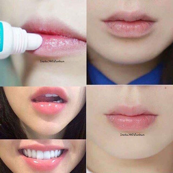 Son dưỡng giảm thâm môi làm hồng môi Mediheal Labocare Panteno Lips